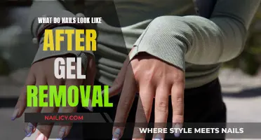 Gel Removal: Nails in Recovery
