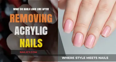 The Ugly Truth About Post-Acrylic Nails