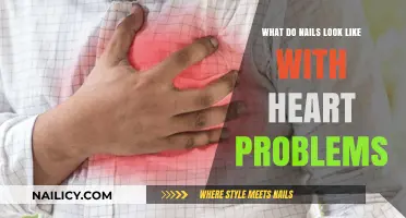 Heart Health Clues: What Your Nails Reveal About Cardiac Issues
