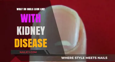Kidney Disease and Nail Changes: What to Look For