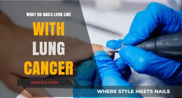 Lung Cancer's Silent Sign: Unusual Nail Changes to Watch For