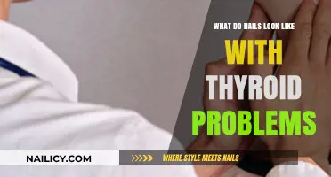 Thyroid and Nail Health: Uncovering the Visible Signs of Imbalance