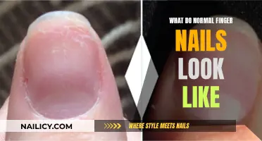 Unveiling the Natural Look: Understanding Normal Nail Appearance