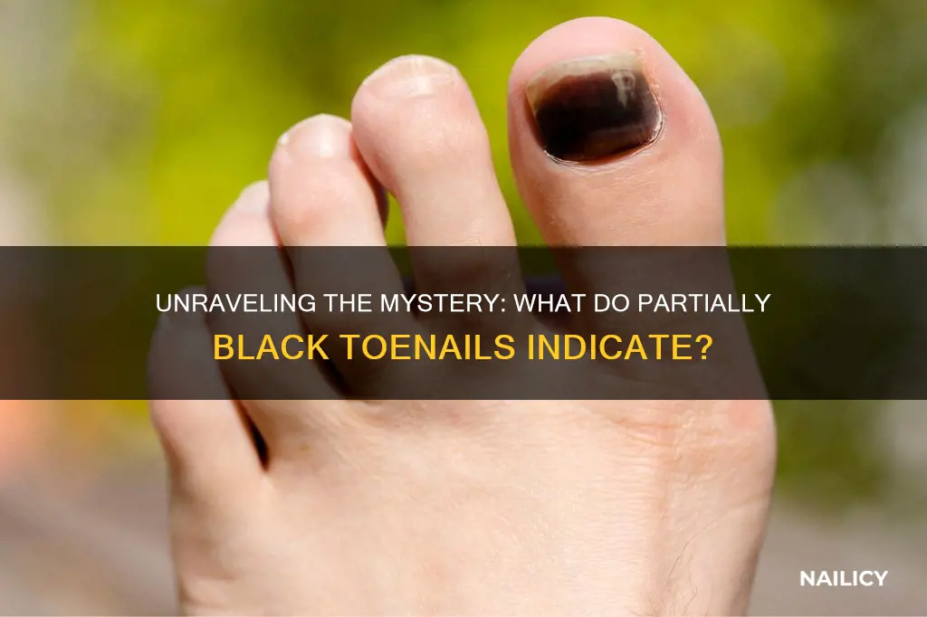 what do partially black nails mean on a woman toenails