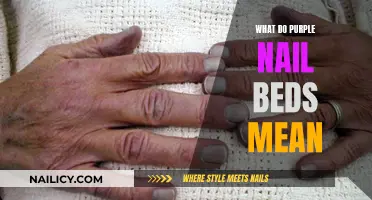 Purple Nail Beds: Uncover the Hidden Health Clues