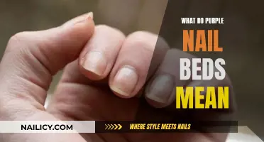 Purple Nail Beds: What Do They Indicate About Your Health?