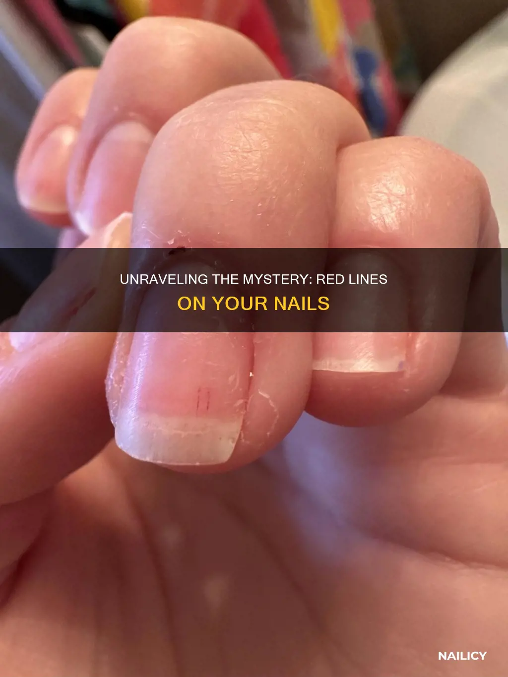 what do red lines on nails mean