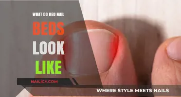 Understanding Red Nail Beds: Appearance, Causes, and When to Worry
