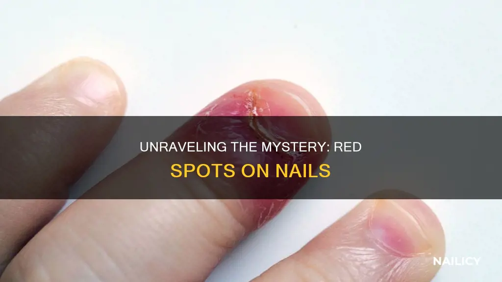 what do red spots on nails mean