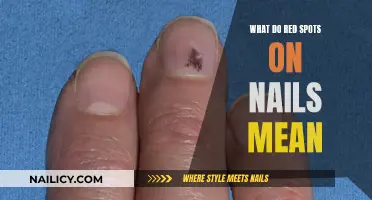 Red Spots on Nails: What Your Body is Trying to Tell You