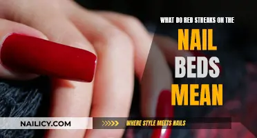 Red Streaks on Nails: What Do They Mean?