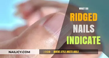 Decoding the Signs: What Do Ridged Nails Indicate About Your Health?
