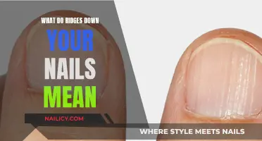 Unraveling the Mystery: What Your Nail Ridges Reveal