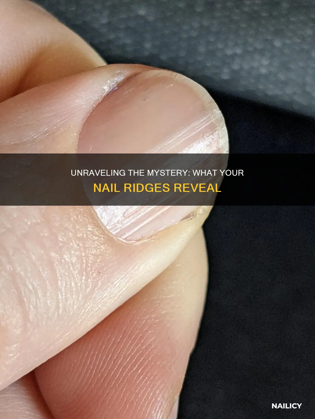 what do ridges down your nails mean