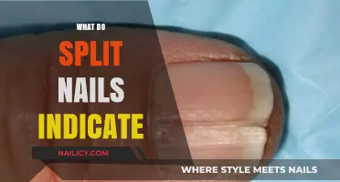 Decoding the Signs: What Split Nails Really Indicate About Your Health