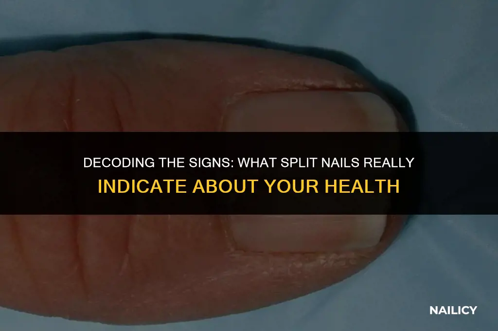 what do split nails indicate