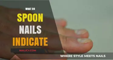 Decoding Spoon Nails: What They Reveal About Your Health
