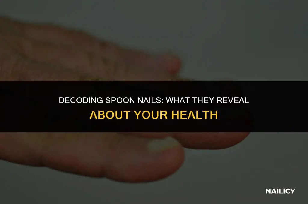 what do spoon nails indicate