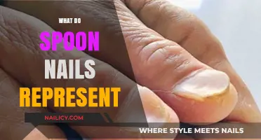Decoding the Meaning: What Do Spoon Nails Represent?