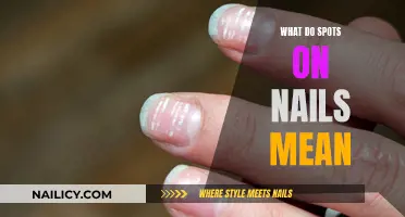 Unraveling the Mystery: What Your Nail Spots Reveal