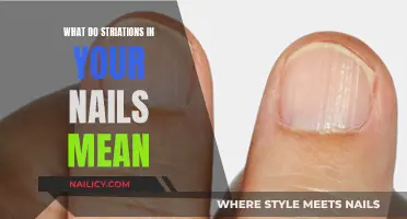 Unraveling the Mystery: What Your Striated Nails Reveal