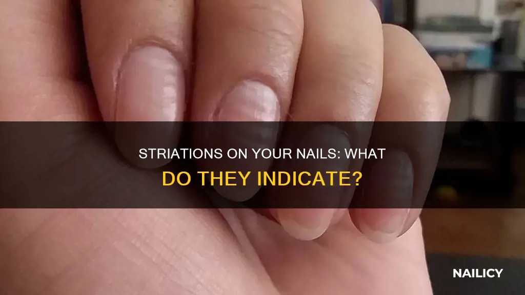 what do striations in your nails mean