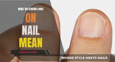 Unraveling the Mystery: What Do Strong Lines on Nails Indicate?