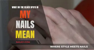 Black Spots on Nails: What Do They Mean?