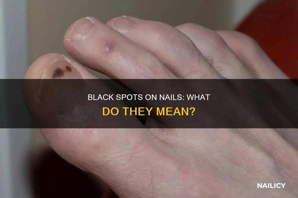 what do the black spots in my nails mean
