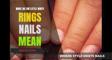 White Nail Rings: What Do They Mean?
