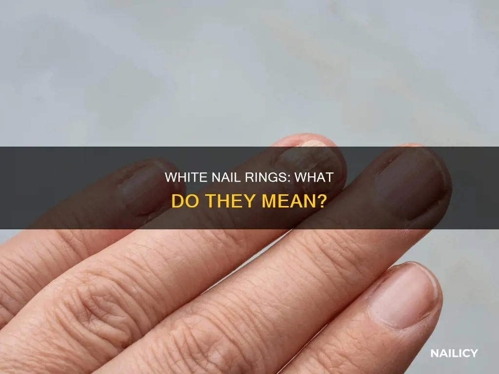 what do the little white rings nails mean