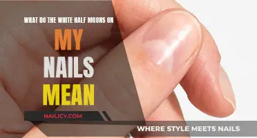 White Half Moons on Nails: What Do They Mean?