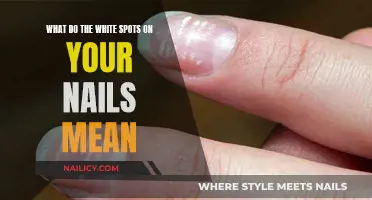 Uncover the Mystery: White Spots on Your Nails