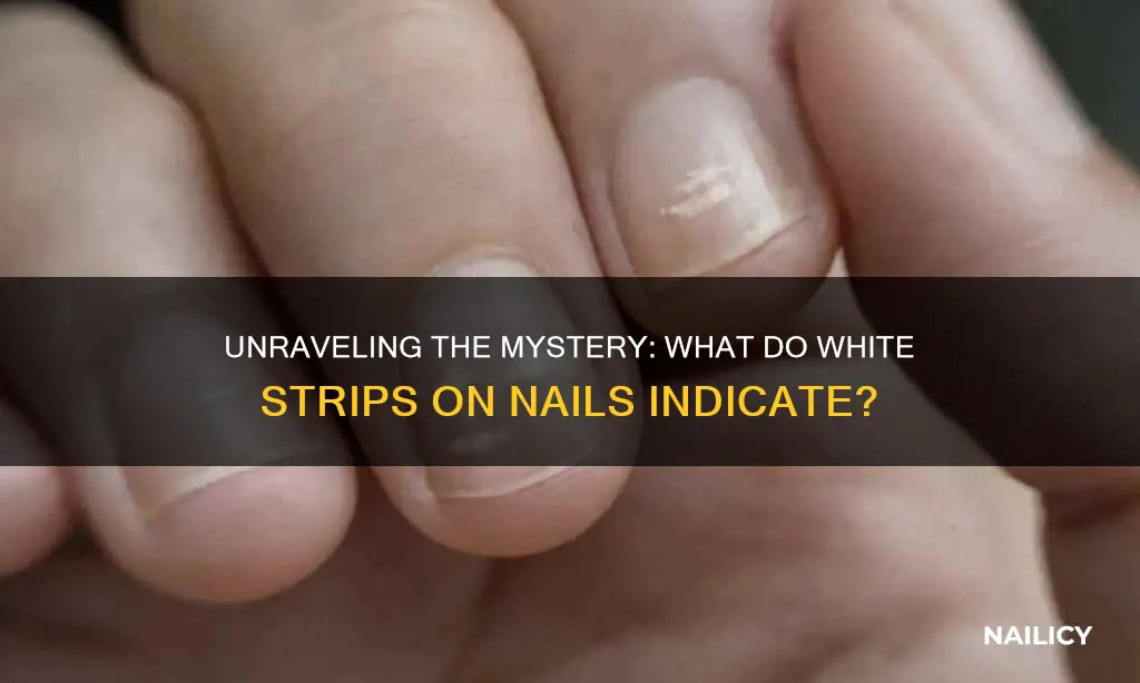 what do the white stripes on your nails mean