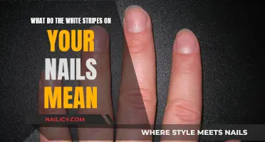 White Stripes on Nails: What's the Meaning?