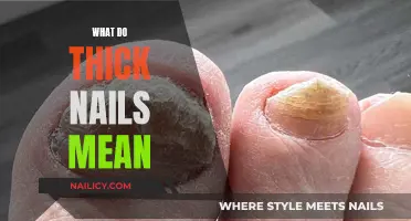 Thick Nails: What Do They Mean for Your Health?