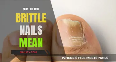 The Truth Behind Thin, Brittle Nails: What Your Body Is Telling