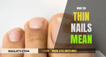 Thin Nails: What Do They Mean for Your Health?