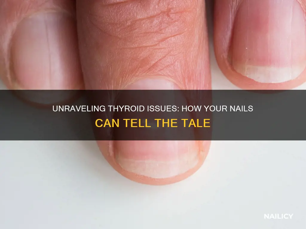 what do thyroid problems look like on finger nails