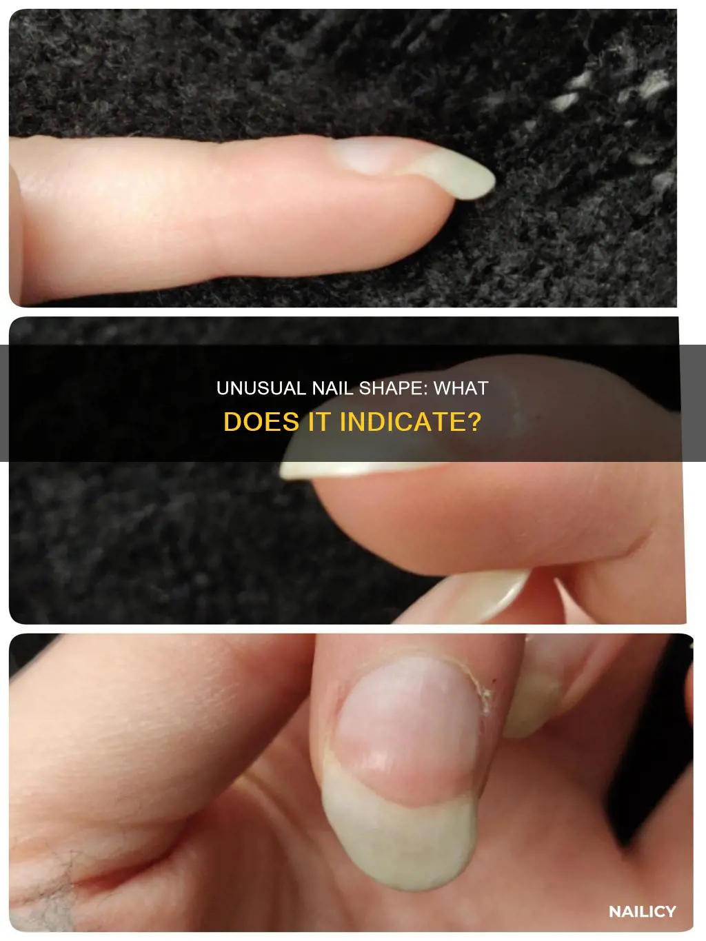 what do uneven nails mean