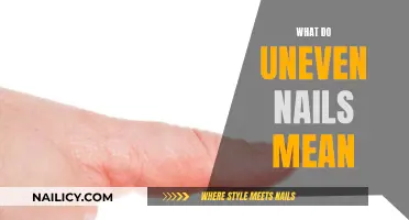 Uneven Nails: What They Mean for Your Health