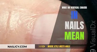 Vertical Nail Ridges: What Do They Mean?