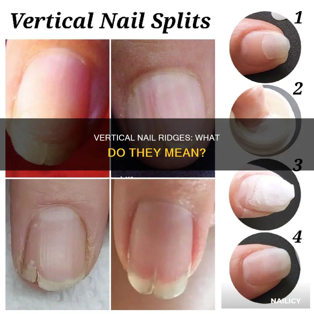what do vertical cracks in nails mean
