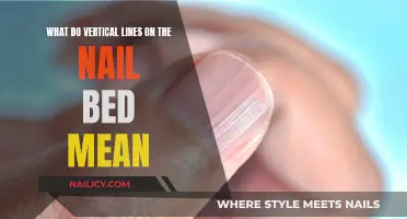 Unraveling the Mystery: What Do Vertical Lines on Your Nails Indicate?