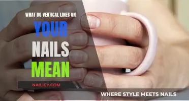 Unraveling the Mystery: Vertical Lines on Your Nails