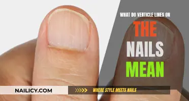 Unraveling the Mystery: Vertical Lines on Your Nails