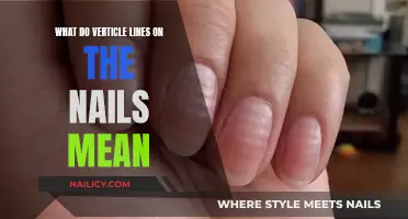 Vertical Lines on Nails: What Do They Indicate?