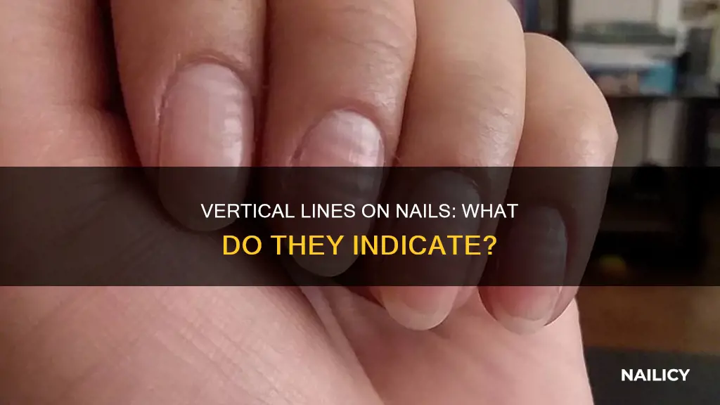 what do verticle lines on the nails mean
