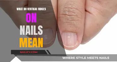 Unraveling the Mystery: Vertical Ridges on Nails