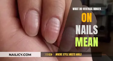 Vertical Ridges on Nails: What Do They Indicate?